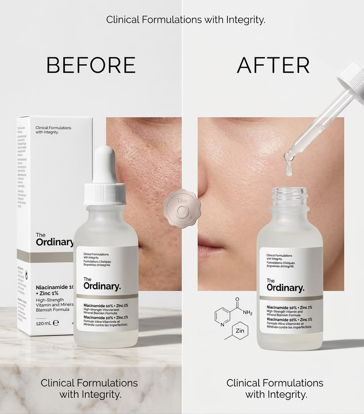 🧴 The Ordinary Salicylic Acid 2%